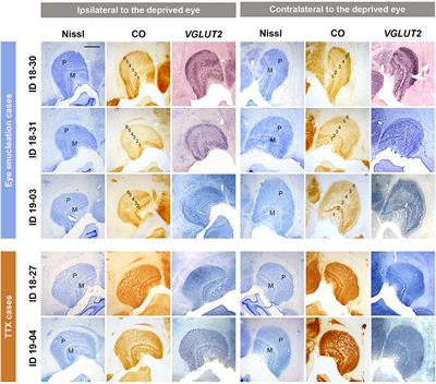 The Expression Patterns of Cytochrome Oxidase and Immediate-Early Genes Show Absence of Ocular Dominance Columns in the Striate Cortex of Squirrel Monkeys Following Monocular Inactivation